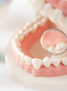 フラップオペレーション